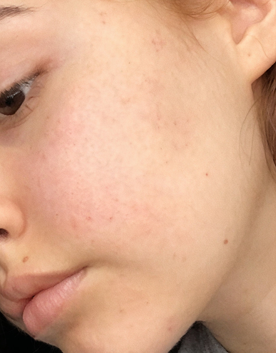 Before treatment
